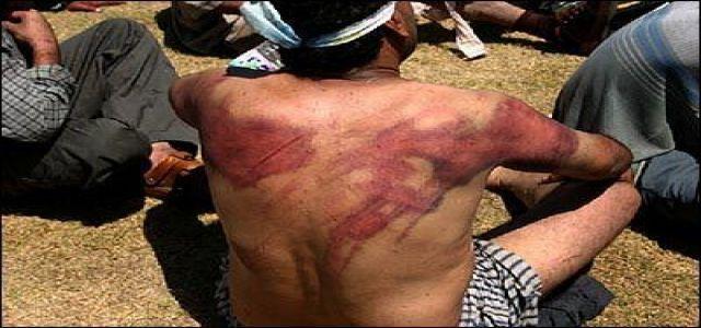 Egypt: Torture and Coerced Confessions Used in High-Profile Terrorism Investigation