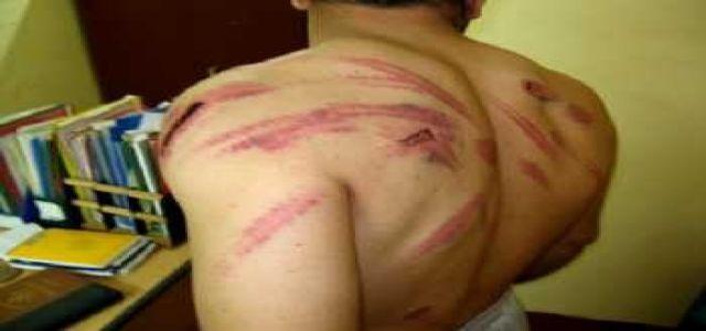 Opening An Investigation Into Torturing Awseem’s Citizen
