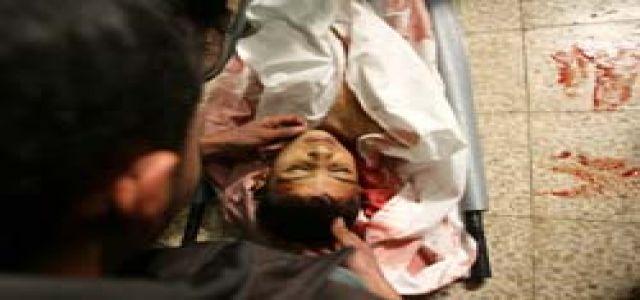 Pictures Showing The Slaughter In Gaza