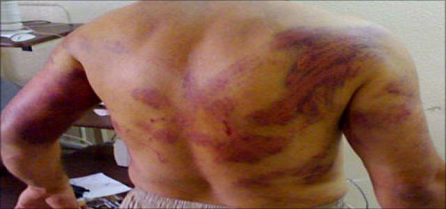 Palestinian prisoner in Egyptian jail in serious health condition